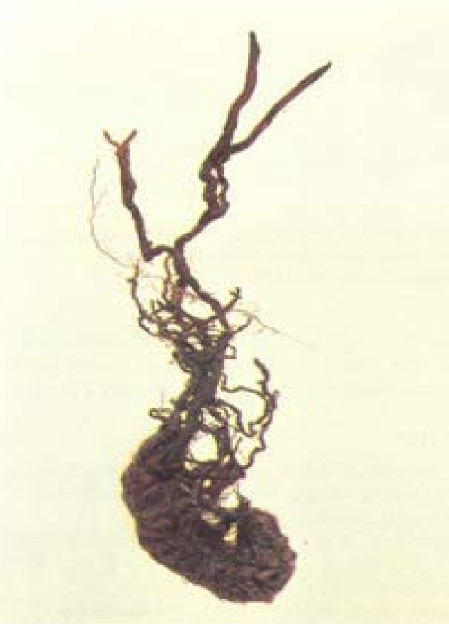 Cordyceps